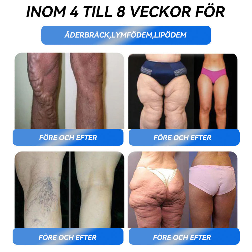 IFMAGIC® GLP-1 Pro Oral lösning för viktminskning 🌵En dos per dag – synliga resultat inom 7 dagar👩⚕️Lämplig för fetma, hjärt-kärlsjukdomar, diabetes, sömnapné, högt kolesterol och höga blodfetter, ledproblem med mera